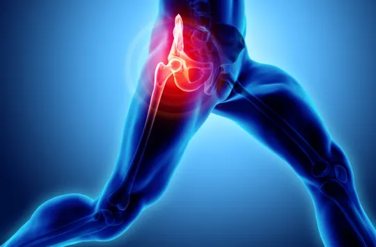 hip pain