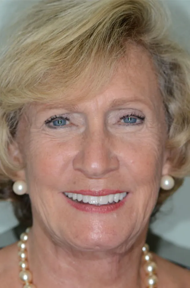 a close-up of a woman smiling