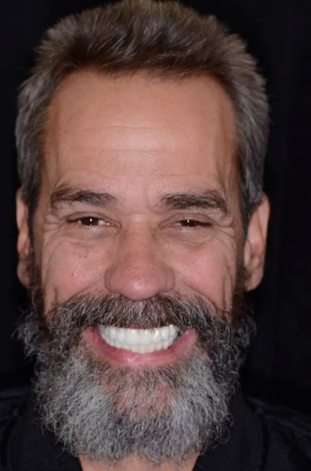 a man with a beard