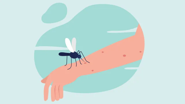 Illustration of a mosquito biting a human arm causing red itchy bumps against a blue background.