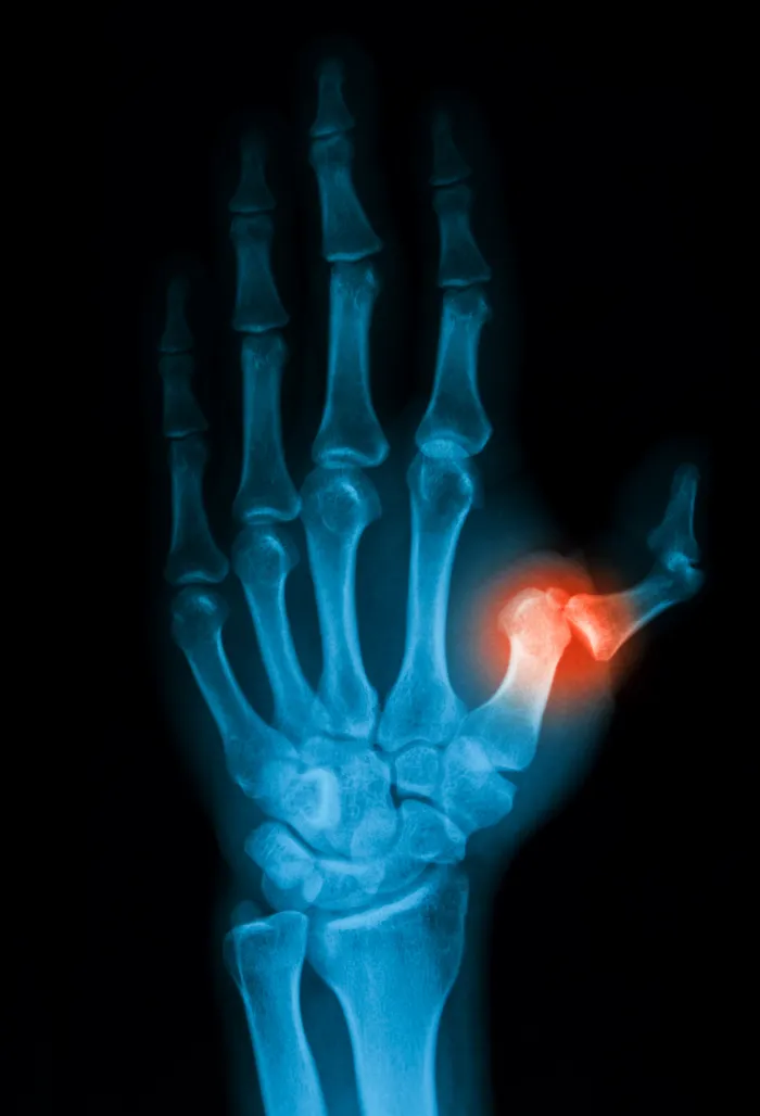 Diagnosing Your Hand Pain With State of the Art Technology