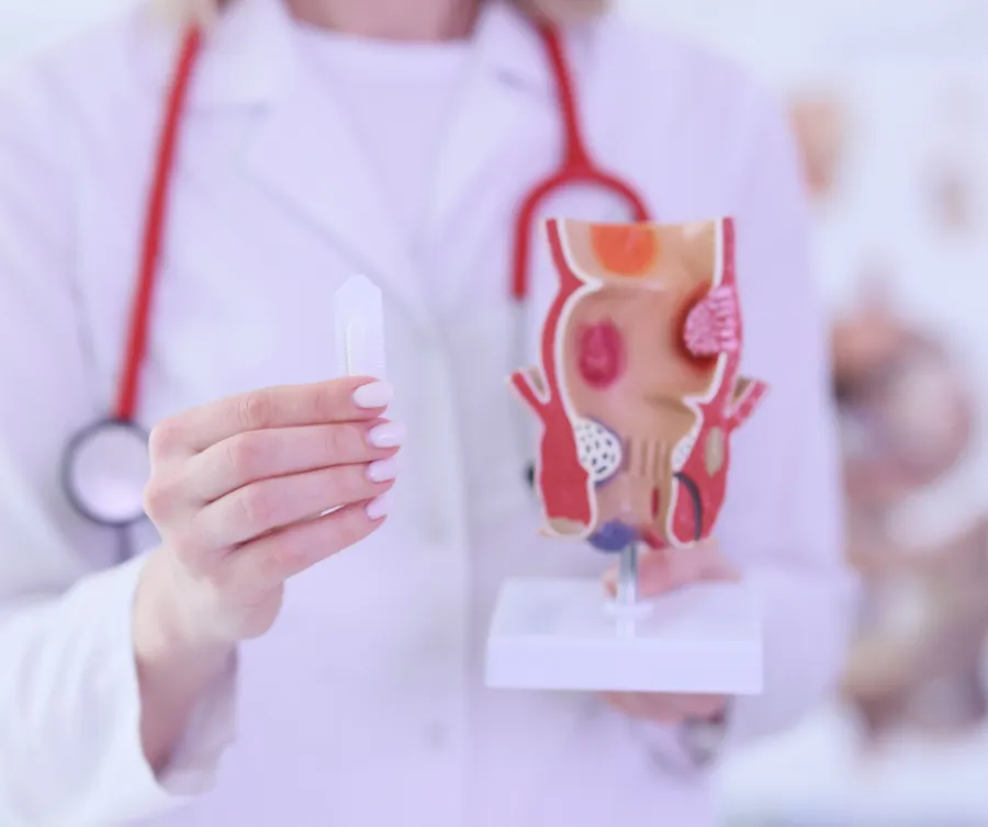 Doctor holding a medical model of the human colon and a small medical device, focusing on colorectal health.