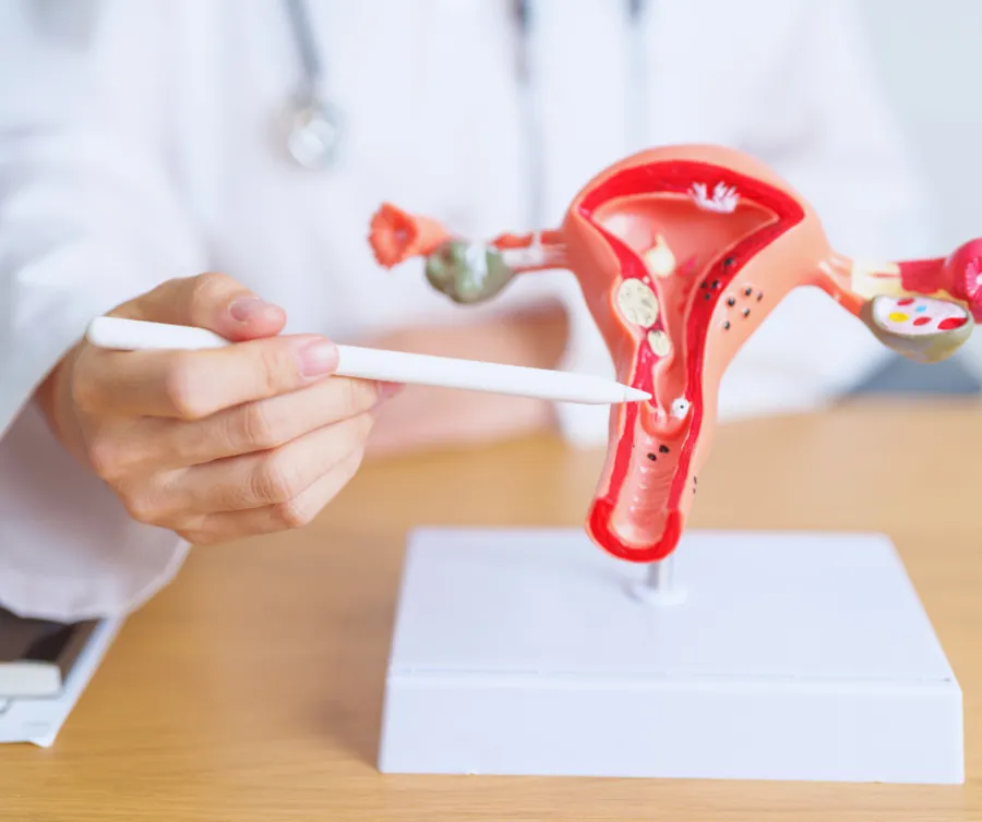 Doctor pointing at a detailed female reproductive system model highlighting the uterus and ovaries.