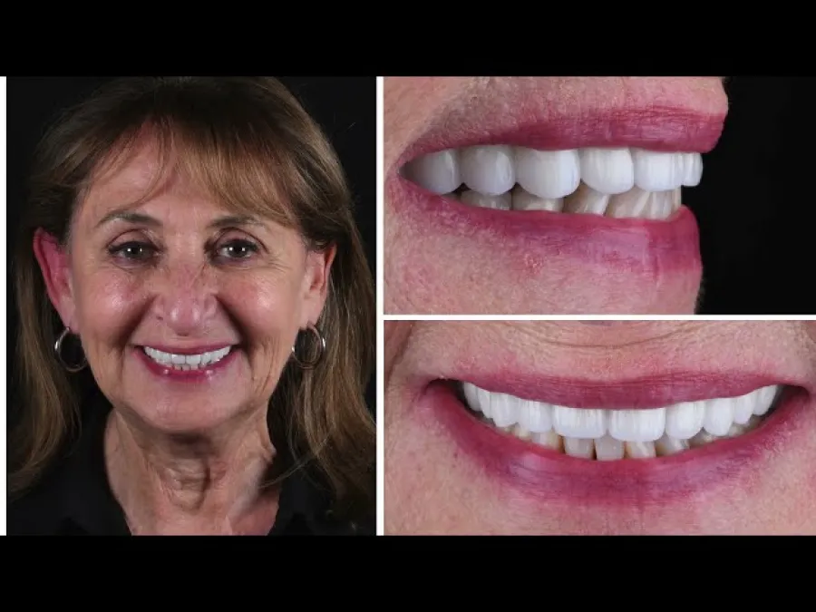 a person smiling