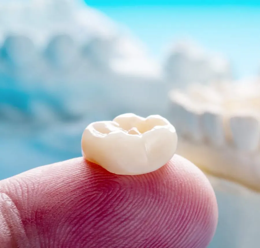 Close-up of a dental crown resting on a fingertip with a blurred dental model in the background
