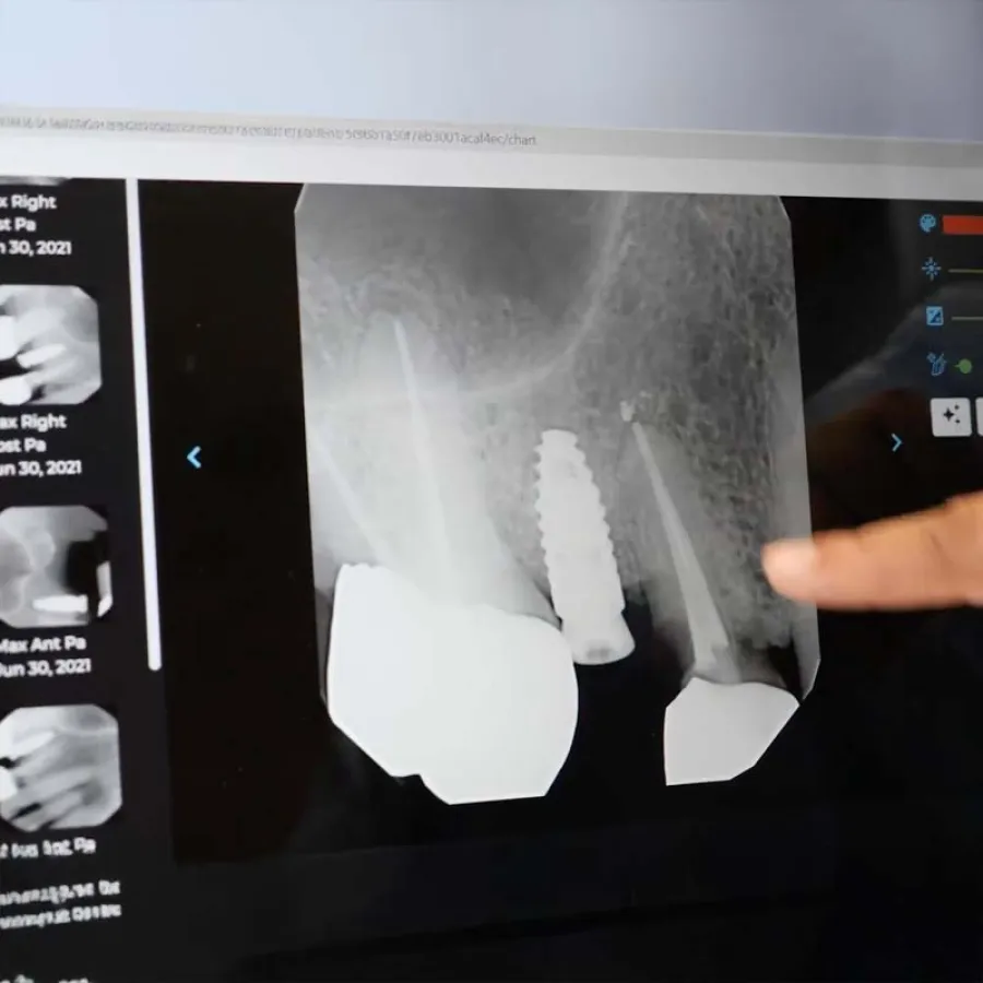 a hand holding a white x-ray of a person's head