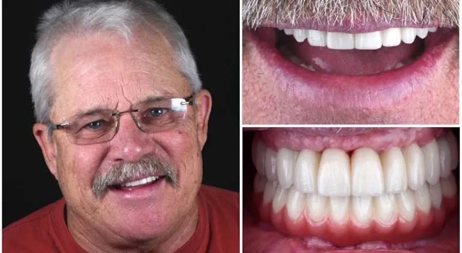 a man with a mustache