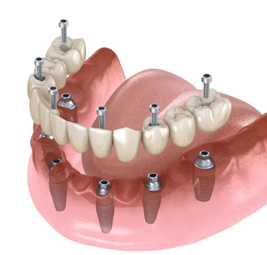 Dentist with magnifying glasses talking and smiling to a female patient in a clinic setting.