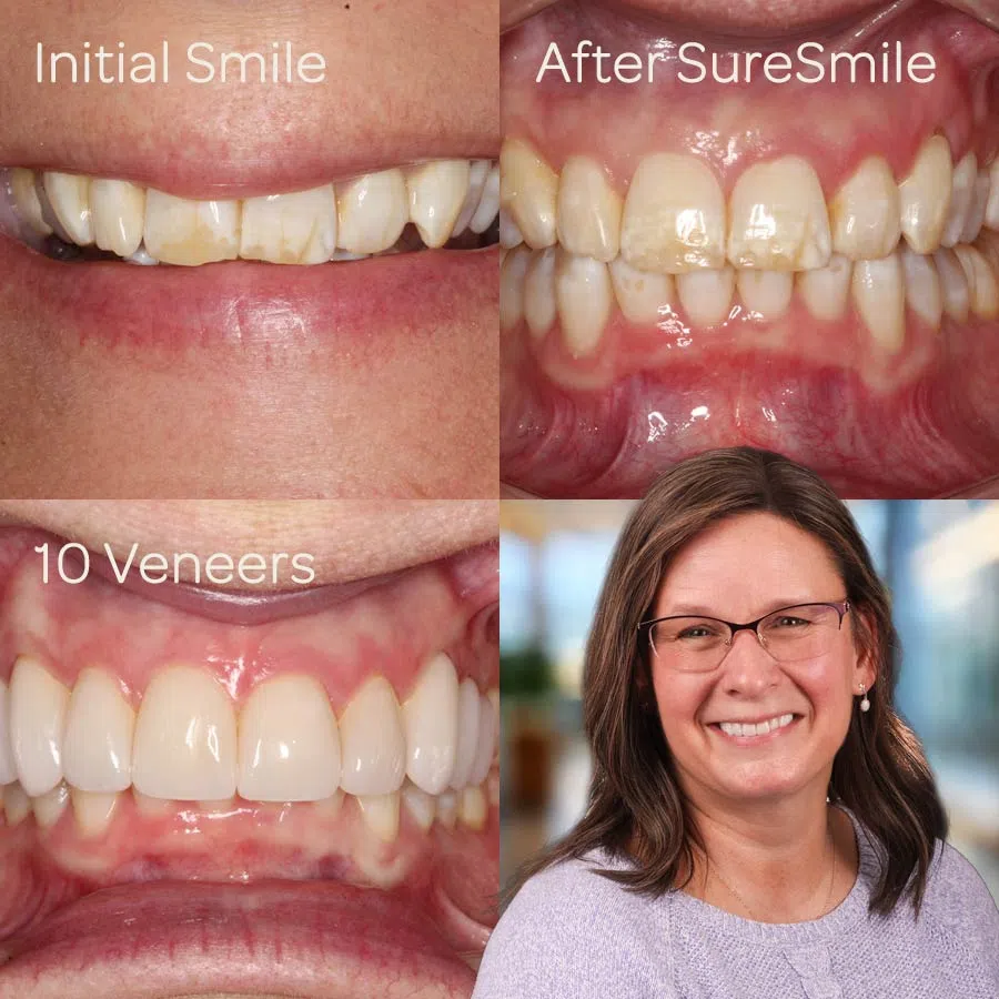 Every Smile Tells a Story