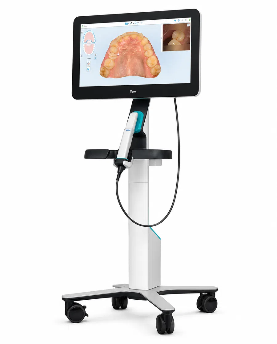 iTero dental scanner on a mobile stand displaying a 3D digital model of upper teeth on screen.