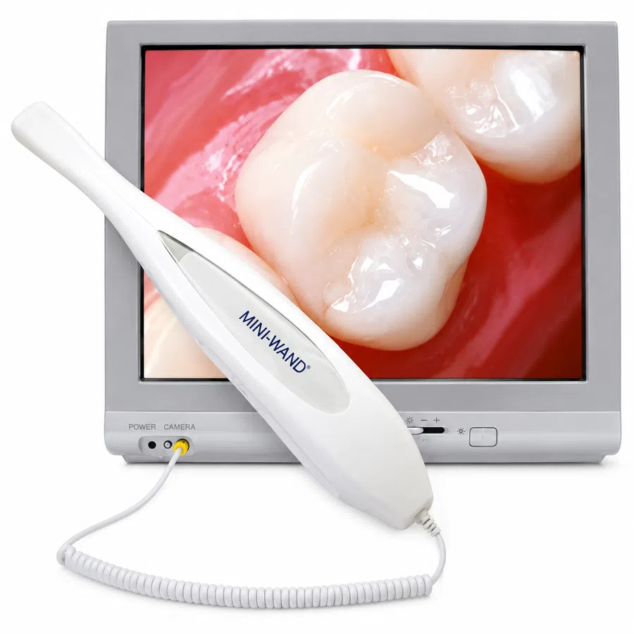 Digital intraoral camera showing a close-up image of healthy teeth on a monitor screen
