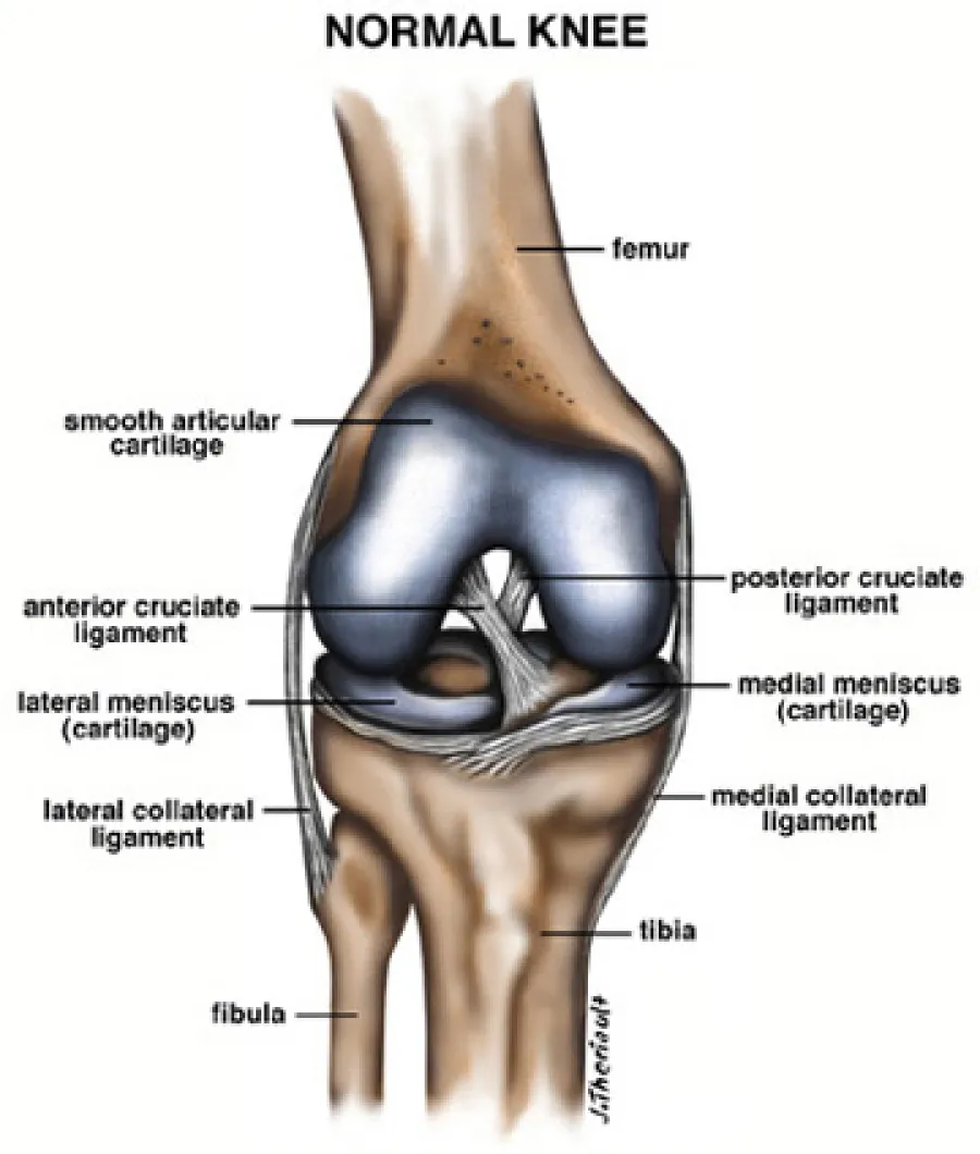 Detailed labeled diagram of a normal human knee showing bones, ligaments, and cartilage.