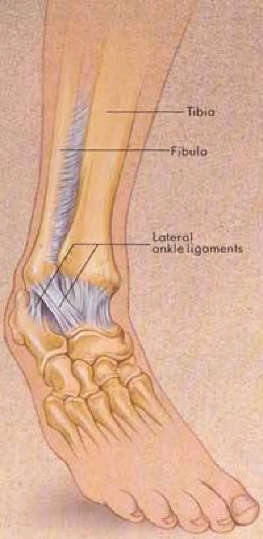 Ankle anatomy illustration showing tibia, fibula bones, and lateral ankle ligaments in the human foot.