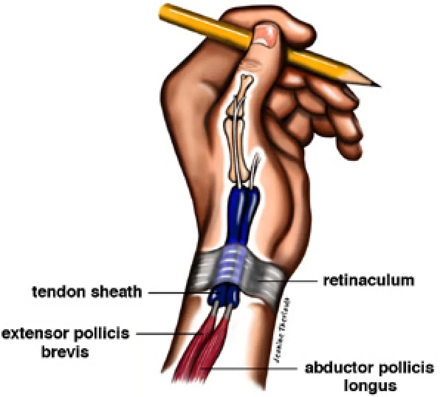 Anatomical illustration of a hand holding a pencil showing tendons, retinaculum, and muscles labeled for reference.