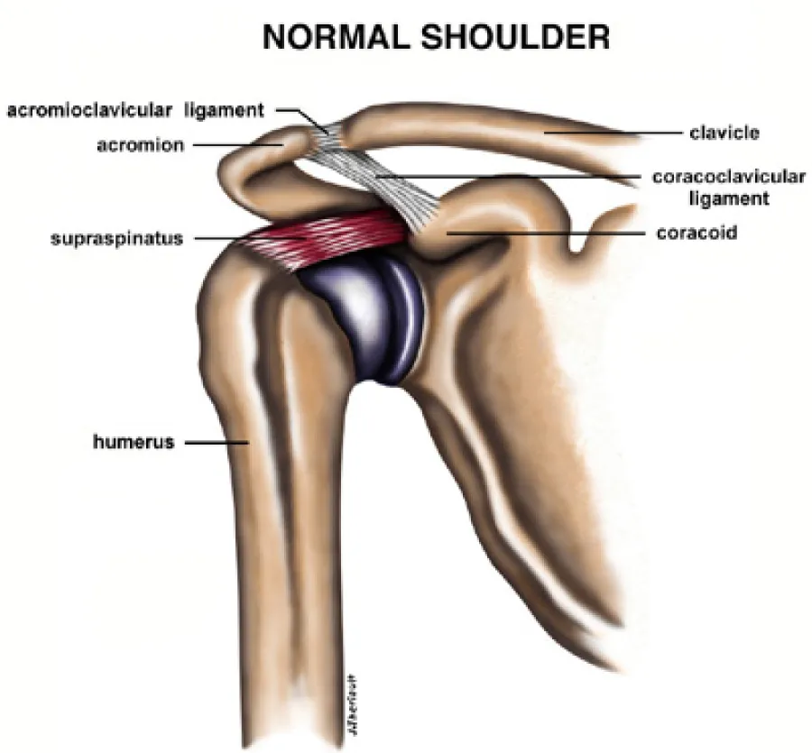 Anatomical diagram of a normal shoulder highlighting bones, ligaments, and the supraspinatus muscle.
